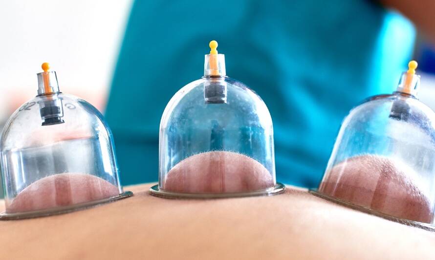 Cupping Service Options