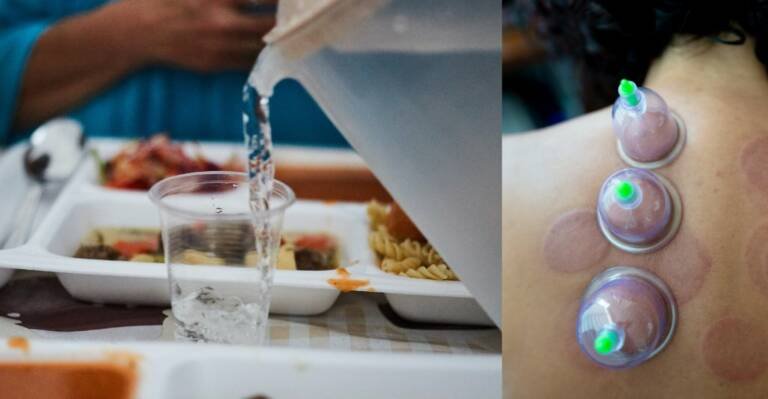 Can You Do Hijama Cupping Whilst Fasting?