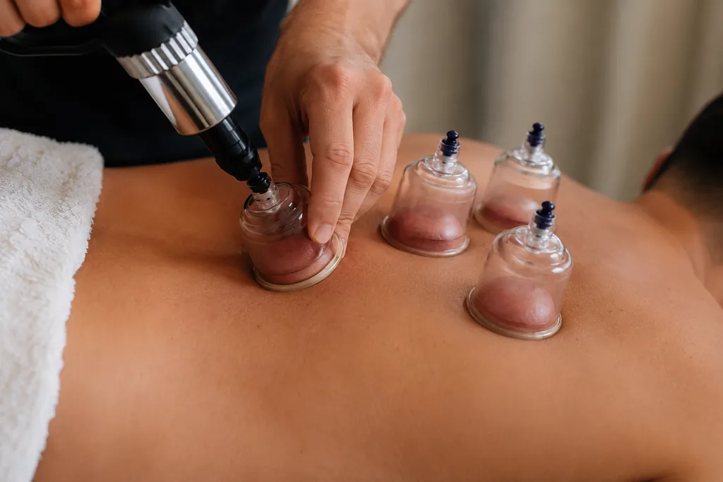 Targeted cupping within a recovery session for muscular work load
